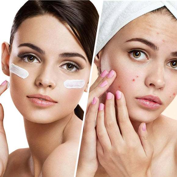 Acne & Blemish Control